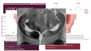 UTERO BICORNE
 Fusión incompleta de los conductos de Muller.
 Dos cavidades endometriales separadas,
comunicantes, único cuello.
 Culminación razonable de embarazos (60%).
 Parto prematuro.
 Incidencia de 66% de parto prematuro y menor
supervivencia fetal en el completo.
Dx: histerosalpingografia (cuernos
uterinos divergentes).
ECOGRAFIA (88%).
Resonancia magnética.
TRATAMIENTO: metroplastia de
Strassman.
 