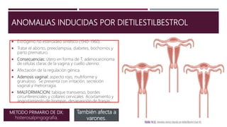 ANOMALIAS INDUCIDAS POR DIETILESTILBESTROL
 Estrógeno no esteroideo sintético (1940-1960).
 Tratar el aborto, preeclampsia, diabetes, bochornos y
parto prematuro.
 Consecuencias: útero en forma de T, adenocarcinoma
de células claras de la vagina y cuello uterino.
 Afectación de la regulación génica.
 Adenosis vaginal: aspecto rojo, multiforme y
granuloso. Se presenta con irritación, secreción
vaginal y metrorragia.
 MALFORMACION: tabique transverso, bordes
circunferenciales y collares cervicales. Acortamiento y
angostamiento de trompas, desaparición de franjas.
METODO PRIMARIO DE DX:
histerosalpingografia.
También afecta a
varones.
 