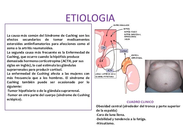 El dolor en el intestino da en los riñones