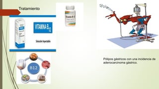 Tratamiento
Pólipos gástricos con una incidencia de
adenocarcinoma gástrico.
 