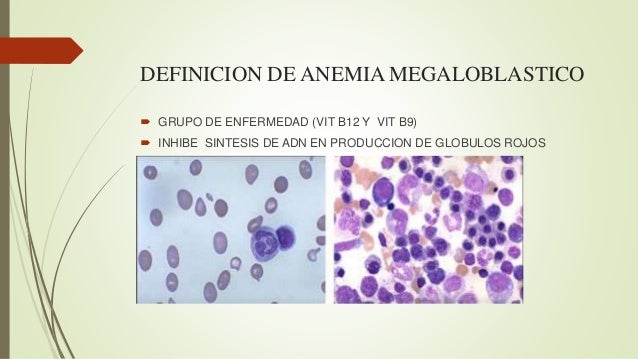 anemia megaloblastica
