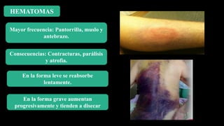 HEMATOMAS
En la forma leve se reabsorbe
lentamente.
Mayor frecuencia: Pantorrilla, muslo y
antebrazo.
En la forma grave aumentan
progresivamente y tienden a disecar
Consecuencias: Contracturas, parálisis
y atrofia.
 