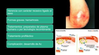 Herencia con carácter recesivo ligado al
sexo
Formas graves: hemartrosis
Tratamientos: preparados de plasma
humano o por tecnología recombinante
Tratamiento profiláctico
Complicación: desarrollo de Ac
 