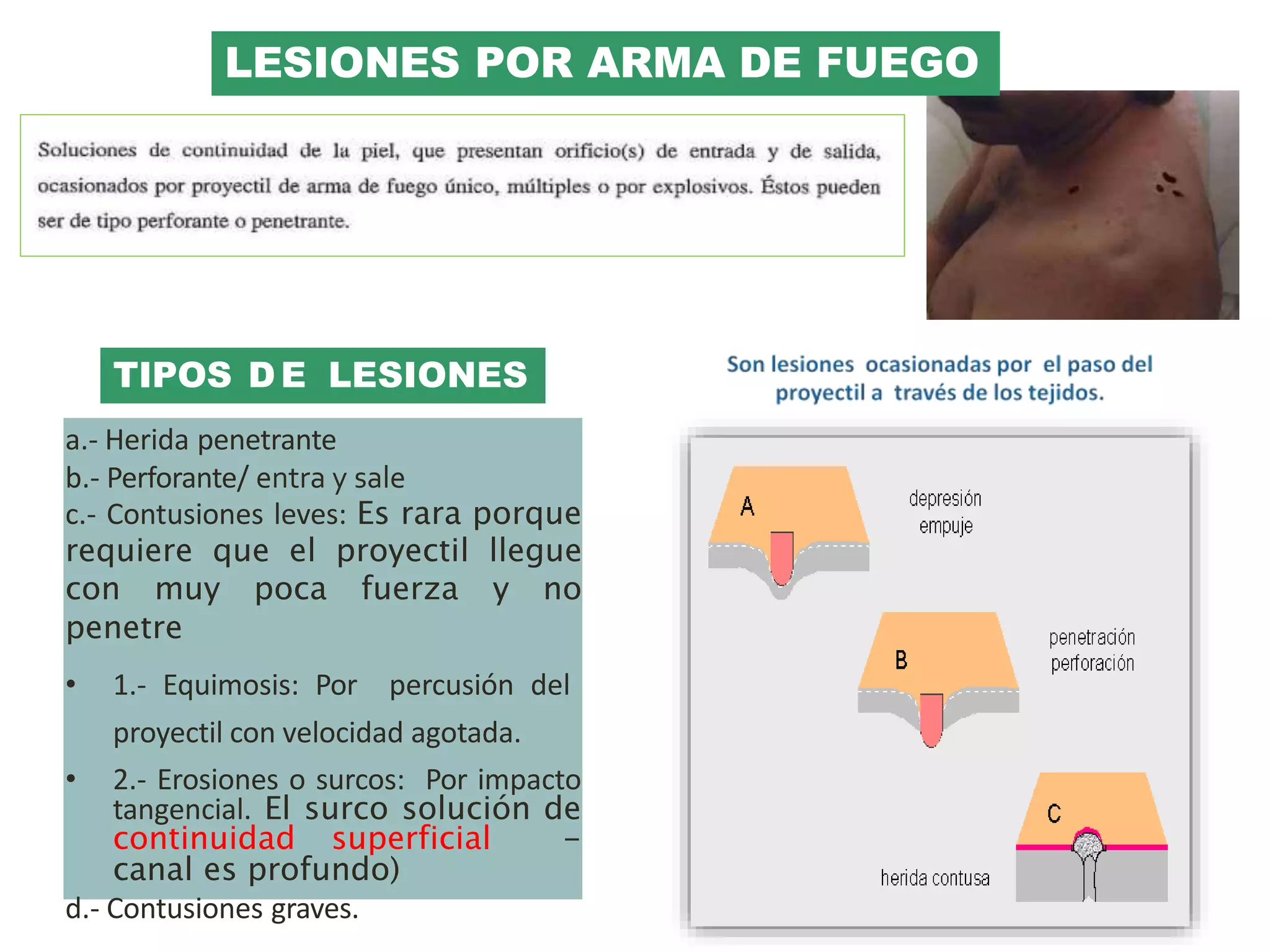 Heridas por arma de fuego | PPTX