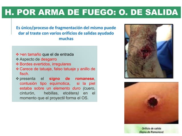 Heridas por arma de fuego | PPTX