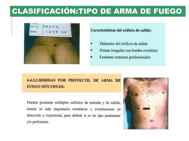 Heridas por arma de fuego | PPTX