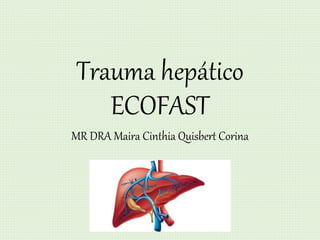 Trauma hepático
ECOFAST
MR DRA Maira Cinthia Quisbert Corina
 
