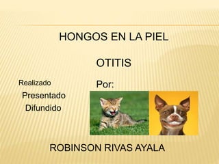 HONGOS EN LA PIEL
OTITIS
Realizado
Presentado
Difundido
Por:
ROBINSON RIVAS AYALA
 