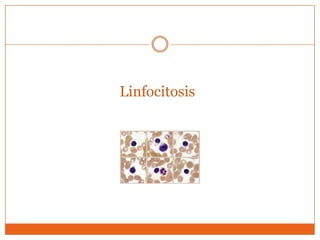 Linfocitosis
 