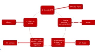 1.-Elevación ST-T
2.-Onda R
disminuye y
aparecen ondas Q
3.-ST desciende y
la onda T se
invierte
4.-Ondas Q de
necrosis y ondas T
negativas de
isquemia.
5.-Onda T se
positiva
Minutos-Horas
A la semana 24 Horas
HorasAl mes
 