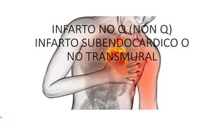 INFARTO NO Q (NON Q)
INFARTO SUBENDOCARDICO O
NO TRANSMURAL
 