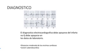 DIAGNOSTICO
•Elevacion moderada de las enzimas cardiacas
•Lesion subendocardica
El diagnostico electrocardiografico debe apoyarse del infarto
no Q debe apoyarse en
los datos de laboratorio.
 
