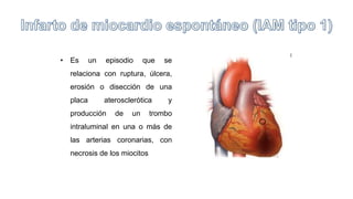 • Es un episodio que se
relaciona con ruptura, úlcera,
erosión o disección de una
placa aterosclerótica y
producción de un trombo
intraluminal en una o más de
las arterias coronarias, con
necrosis de los miocitos
 