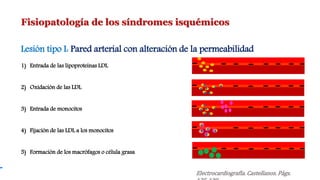 Fisiopatología de los síndromes isquémicos
Lesión tipo I: Pared arterial con alteración de la permeabilidad
1) Entrada de las lipoproteínas LDL
2) Oxidación de las LDL
3) Entrada de monocitos
4) Fijación de las LDL a los monocitos
5) Formación de los macrófagos o célula grasa
Electrocardiografía. Castellanos. Págs.
 
