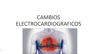 CAMBIOS
ELECTROCARDIOGRAFICOS
 