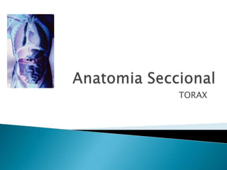 AnatomiaSeccional TORAX 