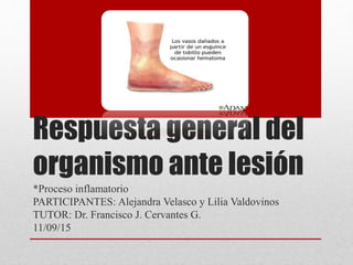 Respuesta general del
organismo ante lesión
*Proceso inflamatorio
PARTICIPANTES: Alejandra Velasco y Lilia Valdovinos
TUTOR: Dr. Francisco J. Cervantes G.
11/09/15
 
