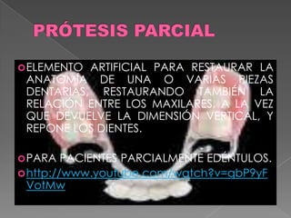 ELEMENTO ARTIFICIAL PARA RESTAURAR LA
ANATOMÍA DE UNA O VARIAS PIEZAS
DENTARIAS, RESTAURANDO TAMBIÉN LA
RELACIÓN ENTRE LOS MAXILARES, A LA VEZ
QUE DEVUELVE LA DIMENSIÓN VERTICAL, Y
REPONE LOS DIENTES.
PARA PACIENTES PARCIALMENTE EDÉNTULOS.
http://www.youtube.com/watch?v=qbP9yF
VotMw
 