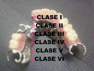 CLASE I
CLASE II
CLASE III
CLASE IV
CLASE V
CLASE VI
 