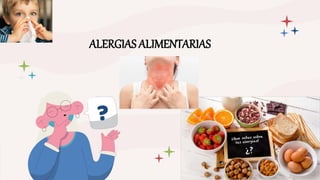 ALERGIAS ALIMENTARIAS
 