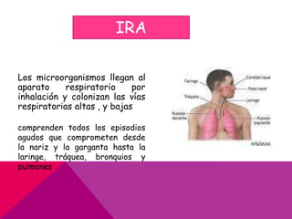 IRA Los microorganismos llegan al aparato respiratorio por inhalación y colonizan las vías respiratorias altas , y bajas  comprenden todos los episodios agudos que comprometen desde la nariz y la garganta hasta la laringe, tráquea, bronquios y pulmones 