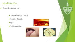 Localización.
 Se puede presentar en:
 Sistema Nervioso Central.
 Intestino Delgado.
 Ojos.
 Tejido Muscular.
 
