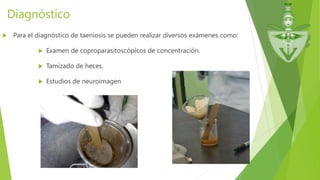 Diagnóstico
 Para el diagnóstico de taeniosis se pueden realizar diversos exámenes como:
 Examen de coproparasitoscópicos de concentración.
 Tamizado de heces.
 Estudios de neuroimagen
 