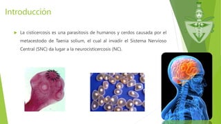 Introducción
 La cisticercosis es una parasitosis de humanos y cerdos causada por el
metacestodo de Taenia solium, el cual al invadir el Sistema Nervioso
Central (SNC) da lugar a la neurocisticercosis (NC).
 