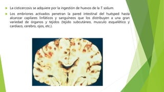  La cisticercosis se adquiere por la ingestión de huevos de la T. solium.
 Los embriones activados penetran la pared intestinal del huésped hasta
alcanzar capilares linfáticos y sanguíneos que los distribuyen a una gran
variedad de órganos y tejidos (tejido subcutáneo, musculo esquelético y
cardiaco, cerebro, ojos, etc.).
 