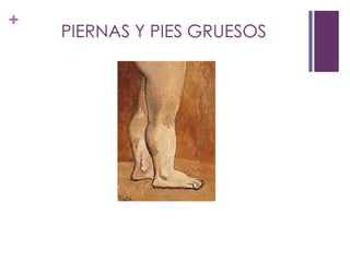 +
    PIERNAS Y PIES GRUESOS
 