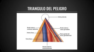 TRIANGULO DEL PELIGRO
 