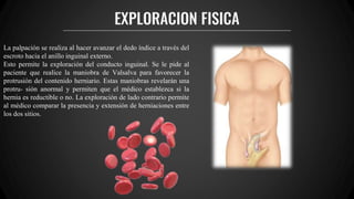 EXPLORACION FISICA
La palpación se realiza al hacer avanzar el dedo índice a través del
escroto hacia el anillo inguinal externo.
Esto permite la exploración del conducto inguinal. Se le pide al
paciente que realice la maniobra de Valsalva para favorecer la
protrusión del contenido herniario. Estas maniobras revelarán una
protru- sión anormal y permiten que el médico establezca si la
hernia es reductible o no. La exploración de lado contrario permite
al médico comparar la presencia y extensión de herniaciones entre
los dos sitios.
 