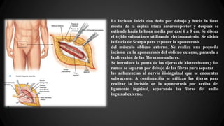 La incisión inicia dos dedo por debajo y hacia la línea
media de la espina iliaca anterosuperior y después se
extiende hacia la línea media por casi 6 a 8 cm. Se diseca
el tejido subcutáneo utilizando electrocauterio. Se divide
la fascia de Scarpa para exponer la aponeurosis
del músculo oblicuo externo. Se realiza una pequeña
incisión en la aponeurosis del oblicuo externo, paralela a
la dirección de las fibras musculares.
Se introduce la punta de las tijeras de Metzenbaum y las
ramas se separan por debajo de las fibras para separar
las adherencias al nervio ilioinguinal que se encuentra
subyacente. A continuación se utilizan las tijeras para
realizar la incisión en la aponeurosis por arriba del
ligamento inguinal, separando las fibras del anillo
inguinal externo.
 