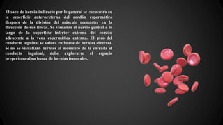 El saco de hernia indirecto por lo general se encuentra en
la superficie anteroexterna del cordón espermático
después de la división del músculo cremáster en la
dirección de sus fibras. Se visualiza el nervio genital a lo
largo de la superficie inferior externa del cordón
adyacente a la vena espermática externa. El piso del
conducto inguinal se valora en busca de hernias directas.
Si no se visualizan hernias al momento de la entrada al
conducto inguinal, debe explorarse el espacio
preperitoneal en busca de hernias femorales.
 