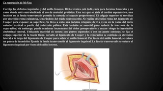 La reparación de McVay:
Corrige los defectos inguinales y del anillo femoral. Dicha técnica está indi- cada para hernias femorales y en
casos donde está contraindicado el uso de material protésico. Una vez que se aísla el cordón espermático, una
incisión en la fascia transversalis permite la entrada al espacio preperitoneal. El colgajo superior se moviliza
por disección roma cuidadosa, separándolo del tejido suprayacente. Se realiza disección roma del ligamento de
Cooper para exponer su superficie. Se lleva a cabo una incisión relajante de 2 a 4 cm en la vaina del recto
anterior vertical a partir del tubérculo púbico. Esta incisión es esencial para reducir la ten- sión de la
reparación; sin embargo, puede ocasionar incremento del dolor posoperatorio y mayor riesgo de herniación
abdominal ventral. Utilizando material de sutura con puntos separados o con un punto continuo, se fija el
colgajo superior de la fascia trans- versalis al ligamento de Cooper y la reparación se continúa en dirección
lateral a lo largo del ligamento de Cooper para ocluir el anillo femoral. Por fuera del anillo femoral, se coloca
un punto de transición fijando la fascia transversalis al ligamento inguinal. La fascia transversalis se sutura al
ligamento inguinal por fuera del anillo interno.
 