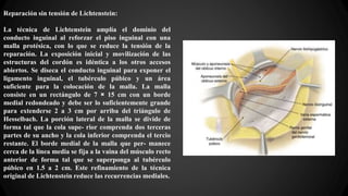 Reparación sin tensión de Lichtenstein:
La técnica de Lichtenstein amplía el dominio del
conducto inguinal al reforzar el piso inguinal con una
malla protésica, con lo que se reduce la tensión de la
reparación. La exposición inicial y movilización de las
estructuras del cordón es idéntica a los otros accesos
abiertos. Se diseca el conducto inguinal para exponer el
ligamento inguinal, el tubérculo púbico y un área
suficiente para la colocación de la malla. La malla
consiste en un rectángulo de 7 × 15 cm con un borde
medial redondeado y debe ser lo suficientemente grande
para extenderse 2 a 3 cm por arriba del triángulo de
Hesselbach. La porción lateral de la malla se divide de
forma tal que la cola supe- rior comprenda dos terceras
partes de su ancho y la cola inferior comprenda el tercio
restante. El borde medial de la malla que per- manece
cerca de la línea media se fija a la vaina del músculo recto
anterior de forma tal que se superponga al tubérculo
púbico en 1.5 a 2 cm. Este refinamiento de la técnica
original de Lichtenstein reduce las recurrencias mediales.
 