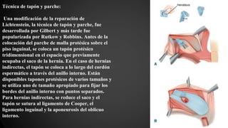 Técnica de tapón y parche:
Una modificación de la reparación de
Lichtenstein, la técnica de tapón y parche, fue
desarrollada por Gilbert y más tarde fue
popularizada por Rutkow y Robbins. Antes de la
colocación del parche de malla protésica sobre el
piso inguinal, se coloca un tapón protésico
tridimensional en el espacio que previamente
ocupaba el saco de la hernia. En el caso de hernias
indirectas, el tapón se coloca a lo largo del cordón
espermático a través del anillo interno. Están
disponibles tapones protésicos de varios tamaños y
se utiliza uno de tamaño apropiado para fijar los
bordes del anillo interno con puntos separados.
Para hernias indirectas, se reduce el saco y el
tapón se sutura al ligamento de Cooper, el
ligamento inguinal y la aponeurosis del oblicuo
interno.
 
