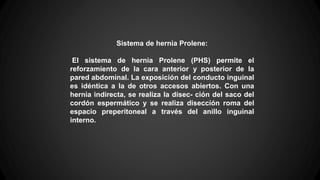 Sistema de hernia Prolene:
El sistema de hernia Prolene (PHS) permite el
reforzamiento de la cara anterior y posterior de la
pared abdominal. La exposición del conducto inguinal
es idéntica a la de otros accesos abiertos. Con una
hernia indirecta, se realiza la disec- ción del saco del
cordón espermático y se realiza disección roma del
espacio preperitoneal a través del anillo inguinal
interno.
 
