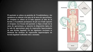 El paciente se coloca en posición de Trendelenburg y los
monitores se colocan a los pies de la mesa de operaciones.
El cirujano se coloca en el lado opuesto al sitio de la
hernia y el ayudante permanece de pie en el lado opuesto
al cirujano. Los brazos del paciente se fijan al lado de la
mesa de operaciones. se muestra la disposición típica de
la sala de operaciones para la reparación laparoscópica
de una hernia inguinal. En las siguientes secciones se
destacan las técnicas de reparación laparoscópica de
hernia inguinal realizadas más a menudo.
 