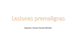 Expositor: Chavez Huaroto Mishelle
 