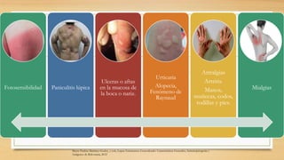 Fotosensibilidad Paniculitis lúpica
Ulceras o aftas
en la mucosa de
la boca o nariz.
Urticaria
Alopecia,
Fenómeno de
Raynaud
Artralgias
Artritis.
Manos,
muñecas, codos,
rodillas y pies.
Mialgias
Mayra Paulina Martínez-Godoy, y cols, Lupus Eritematoso Generalizado: Características Generales, Inmunopatogenia y
Antígenos de Relevancia, 2012
 