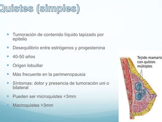  Tumoración de contenido líquido tapizado por
epitelio
 Desequilibrio entre estrógenos y progesterona
 40-50 años
 Origen lobuillar
 Más frecuente en la perimenopausia
 Síntomas: dolor y presencia de tumoración uni o
bilateral
 Pueden ser microquistes <3mm
 Macroquistes >3mm
 
