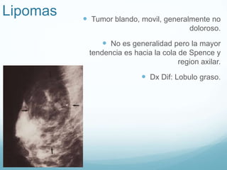 Lipomas  Tumor blando, movil, generalmente no
doloroso.
 No es generalidad pero la mayor
tendencia es hacia la cola de Spence y
region axilar.
 Dx Dif: Lobulo graso.
 