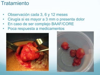 Tratamiento
• Observación cada 3, 6 y 12 meses
• Cirugía si es mayor a 3 mm o presenta dolor
• En caso de ser complejo BAAF/CORE
• Poca respuesta a medicamentos
 