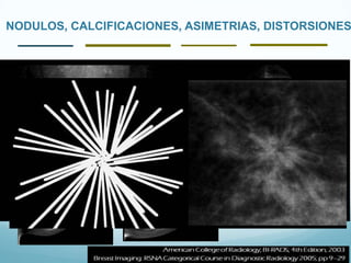 NODULOS, CALCIFICACIONES, ASIMETRIAS, DISTORSIONES
 