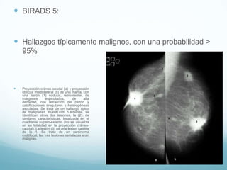  BIRADS 5:
 Hallazgos típicamente malignos, con una probabilidad >
95%
 Proyección cráneo-caudal (a) y proyección
oblícua mediolateral (b) de una mama, con
una lesión (1) nodular, retroareolar, de
márgenes espiculados, de alta
densidad, con retracción del pezón y
calcificaciones irregulares y heterogéneas
asociadas. Se trata de un hallazgo típico
de malignidad, BI-RADS® 5.Además, se
identifican otras dos lesiones, la (2), de
similares características, localizada en el
cuadrante supero-externo (no se visualiza
en su totalidad en la proyección cráneo-
caudal). La lesión (3) es una lesión satélite
de la 1. Se trata de un carcinoma
multifocal, las tres lesiones señaladas eran
malignas.
 