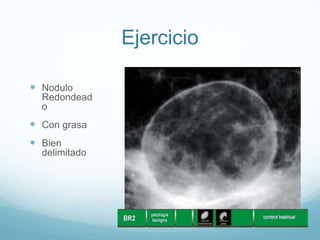 Ejercicio
 Nodulo
Redondead
o
 Con grasa
 Bien
delimitado
 