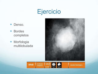Ejercicio
 Denso.
 Bordes
completos
 Morfologia
multilobulada
 