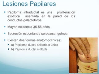 Lesiones Papilares
 Papiloma intraductal es una proliferación
exofítica asentada en la pared de los
conductos galactóforos.
 Mayor incidencia 35-55 años
 Secreción espontánea serosa/sanguínea
 Existen dos formas anatomoclínicas:
 a) Papiloma ductal solitario o único
 b) Papiloma ductal múltiple
 