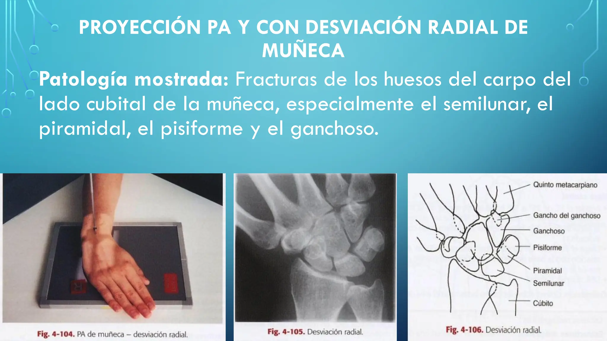 radiografia-de-la-mano-y-la-mu-eca-extremidades-superiores-pptx